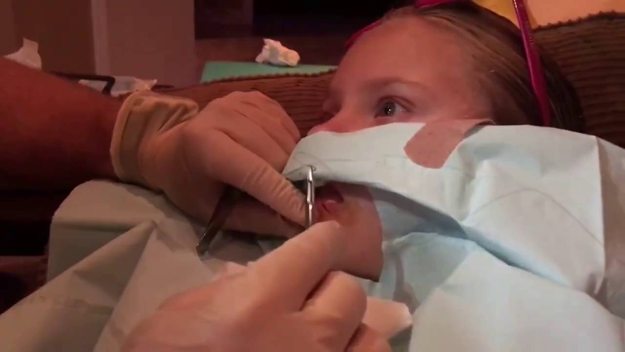 BAILEY GET'S STITCHES FROM DADDY. DOG BITE ON LIP. YouTube