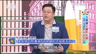 美髮師四肢纖細 卻來做肚子抽脂手術?! 上班這黨事 20171221 (4/4)