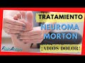 Neuroma de Morton 🦶🏼 Cómo Aliviar el DOLOR 2021 [MASAJE, ESTIRAMIENTOS Y EJERCICIOS]