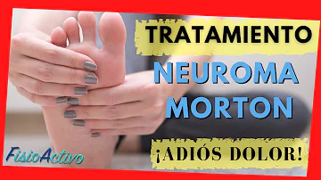 ¿Cómo mejorar el dolor del neuroma de Morton?