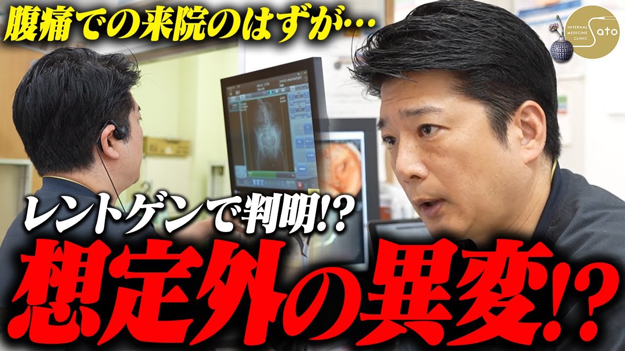 【衝撃】「腹痛での来院がまさかの事態に！？」レントゲンに写った癌の可能性と体の異変... 医師が語った医療の進歩！