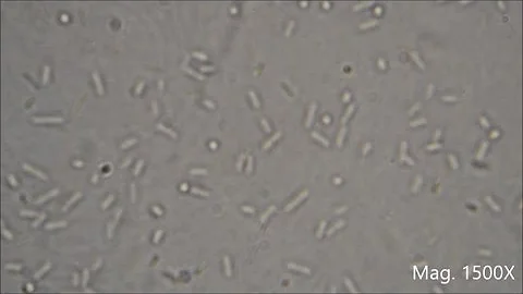 بكتيريا البول