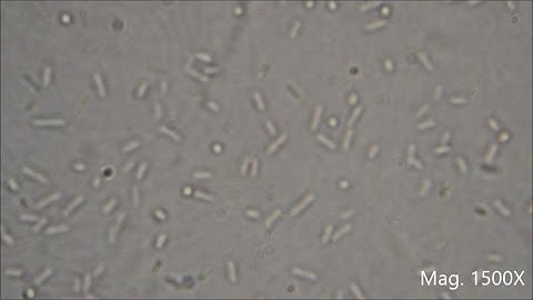 Bacteria under the Microscope (E.  coli and S.  aureus)