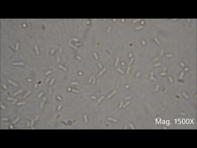 Bacteria Under The Microscope E Coli And S Aureus Youtube