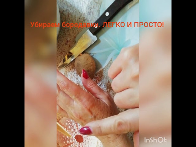 Убираем бородавки. Легко и просто!