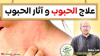 وصفات لعلاج الحبوب و آثار الحبوب / wasafat  dr imad mizab visage