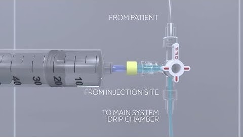 Becker Set up Guide Video