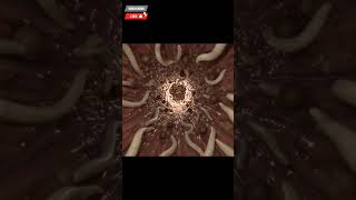 Explore the Human Colon in 3D Ascaris infection simulation.