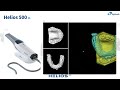 Eighteeth Helios 680 Intraoral Scanner - 2