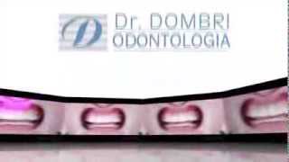 Dr. Dombri Odontologia Resimi