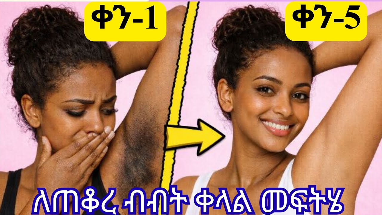 ብብት ለምን ይጠቁራል? መፍትሄውስ?/ Home remedies to get rid of dark armpit 