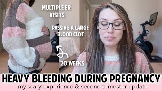 BLEEDING IN PREGNANCY - FIRST & SECOND TRIMESTER BLEEDING | SUBCHORIONIC HEMATOMA? PLACENTA PREVIA? screenshot 3