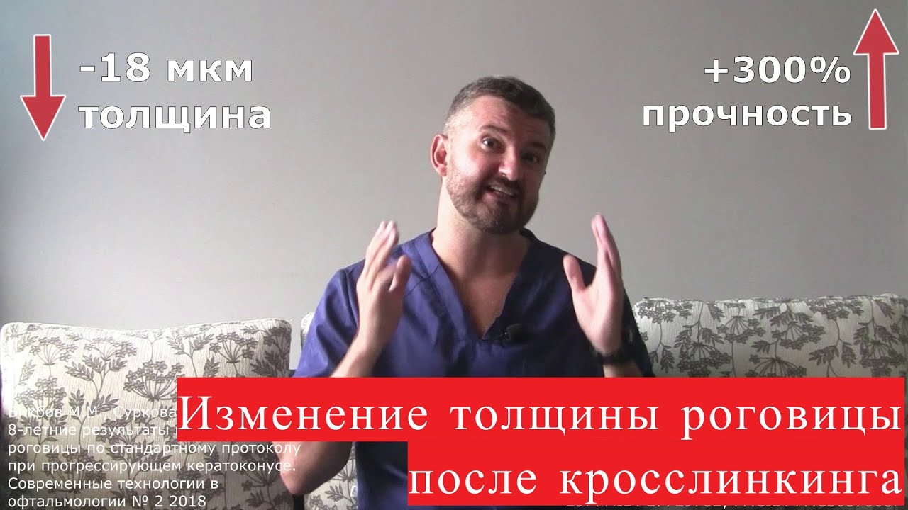 Изменение толщины роговицы после кросслинкинга (увеличение и уменьшение пахиметрии) при кератоконусе