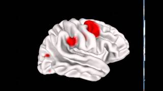 NeuroGuide Brain Surfer Surface Projection