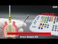 Izen implant  zenex surgery kit 