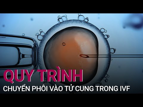 Video: Sự gắn phôi vào tử cung diễn ra vào ngày nào?