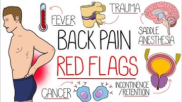 Red Flag Features of Back Pain in 2 Minutes