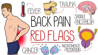 Red Flag Features of Back Pain in 2 Minutes