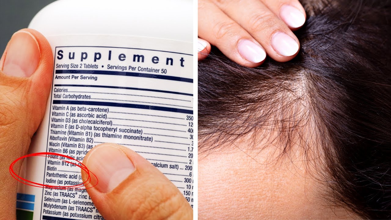This Vitamin May Be The Cure For Your Hair Loss YouTube