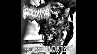 Sarcoidorrhoea - Prolapsed Edematous Tissues (Full Album)