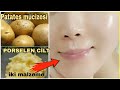 Porselen Bebek Gibi Cilt İçin PATATES MUCİZESİ LEKE GİDERİCİ AYDINLATICI - CİLT BEYAZLATMA MASKESİ