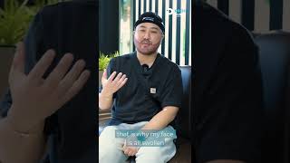 Mr Henry Kim - South Korea - Beard transplant