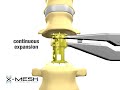 DepuySynthes (Depuy): X Mesh Expandable Cage
