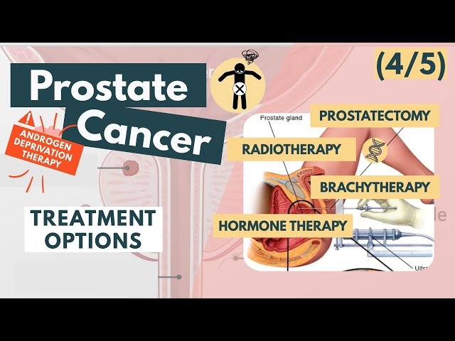 Best Prostate Cancer Hospital In Mumbai