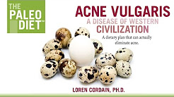 Acne Vulgaris: A Disease of Western Civilization