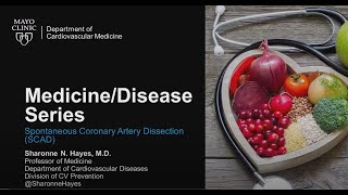 Medicine/Disease Series:  Spontaneous Coronary Artery Dissection (SCAD)