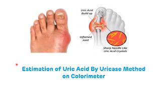 Estimation of Uric Acid By Uricase Method || Estimation of Serum Uric Acid || Biochemistry Practical