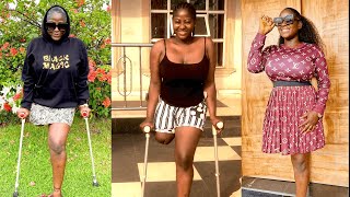 Meet Amputee Nigerian Actress Who Lost Her Leg In An Accident