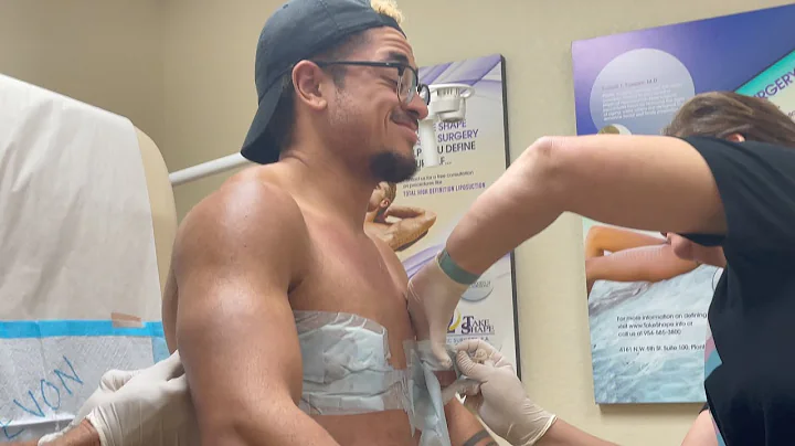 FTM TOP SURGERY REVEAL