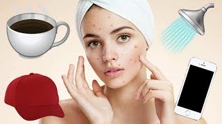10 Things You Didn't Know Caused Acne