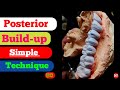 Posterior build up simple technique ceramic anatomy laboratory pfm dentals art porcelain