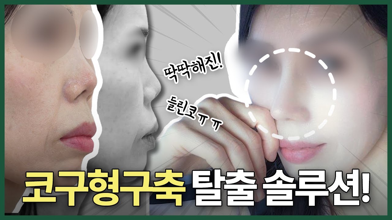 코재수술 당장 빨리 하고 싶은 사람? (Feat. 말랑이 주사)