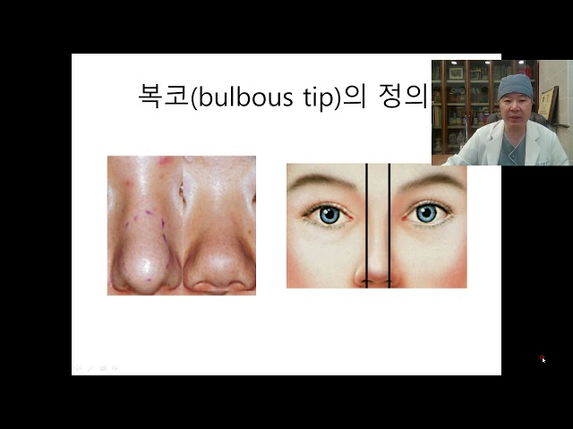 복코의교정