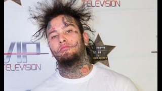 Stitches Apologizes for his Past Antics & Quits Social Media after Getting Bad News from his Doctor.