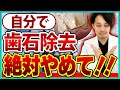 【歯石除去】自分で歯石取りはできる？危険性を解説【家庭用スケーラー】