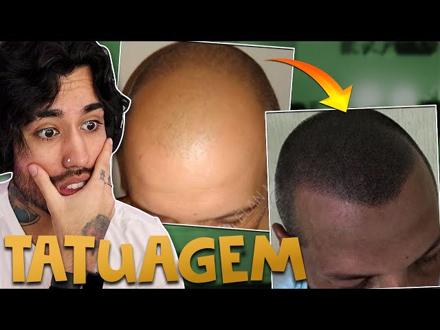 Homem calvo faz tatuagem no lugar do cabelo e viraliza na web: 'Lindo  demais