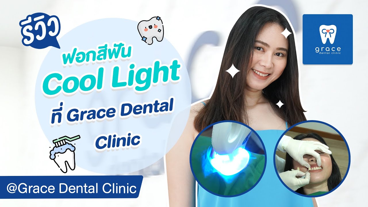 รีวิว ฟอกสีฟัน Cool Light ที่ Grace Dental Clinic มีขั้นตอนยังไงบ้าง