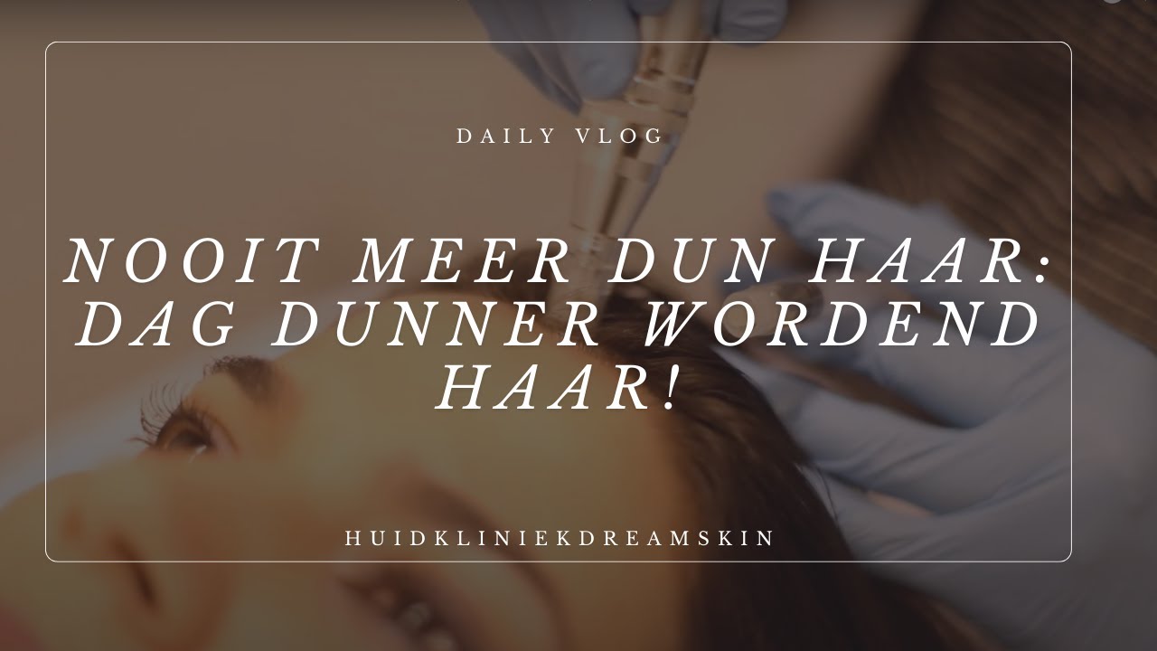 Last van haaruitval of dunner wordende haar? | Huidvideo's | BY Huidkliniek Dreamskin
