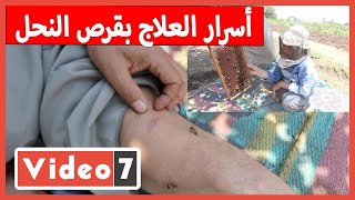 محدش يقدر عليه والعيانين بيجروا.. شاهد أسرار العلاج بقرص النحل