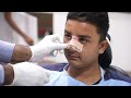 Bend Nose Corrected using Rhinoplasty | Splint Removal | Recovery | Before & After