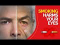 How smoking harms your eyes