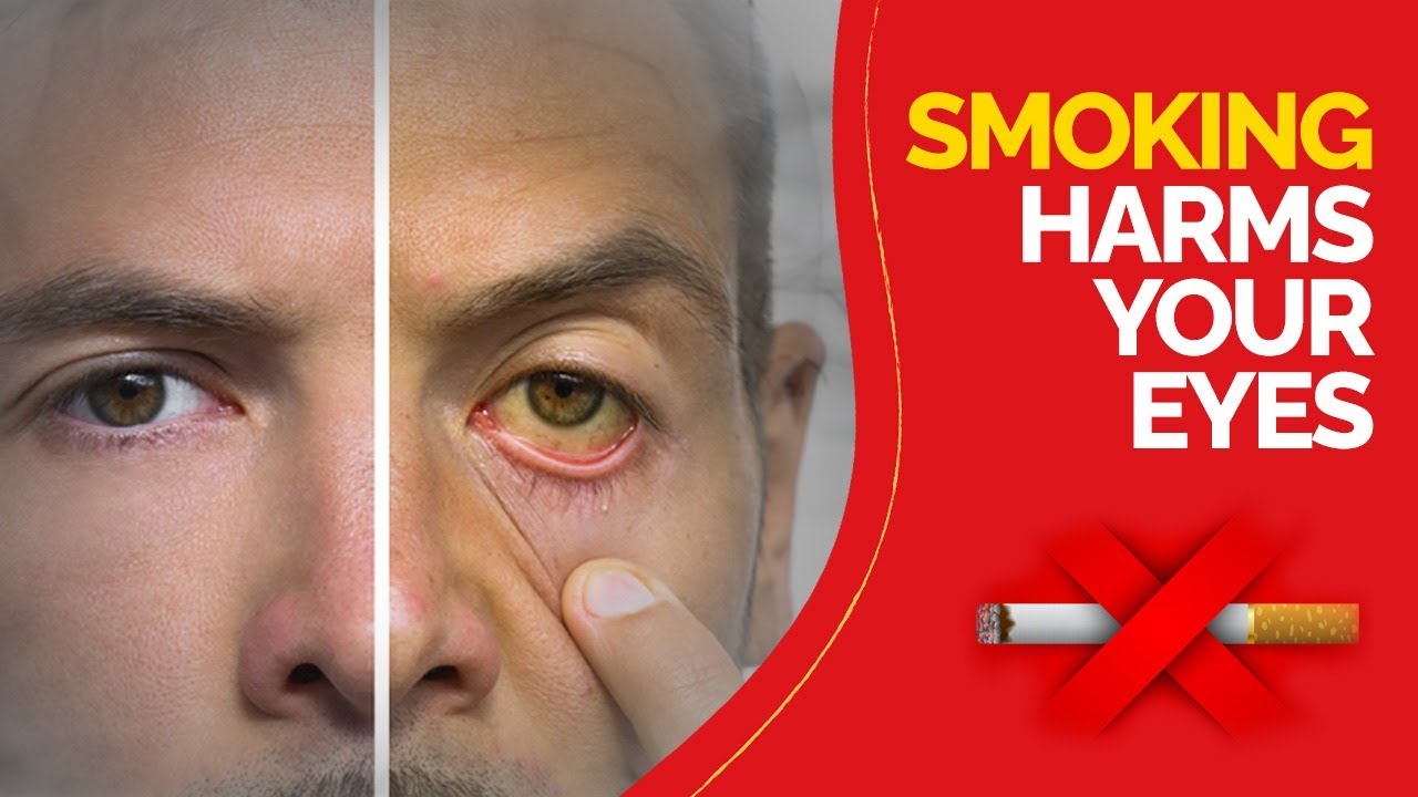 tobacco eyes How smoking harms your eyes