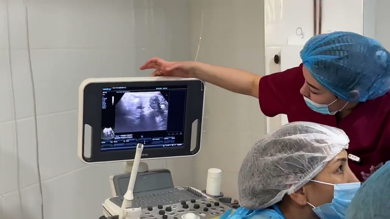 Синдром Ашермана. Процесс операции. Можно ли снова забеременеть ...