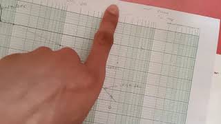 Bode plot example part 4