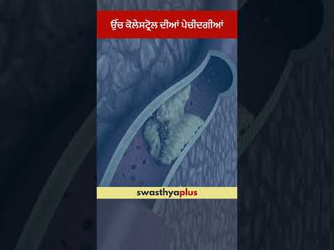 ਉੱਚ ਕੋਲੇਸਟ੍ਰੋਲ ਦੀਆਂ ਪੇਚੀਦਗੀਆਂ | Complications of High Cholesterol | Dr Arun Chopra | #Shorts