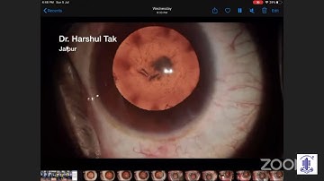 AIOS ARC - Cataract Surgery in Complexities - A Learning-Dr.Harshul tak